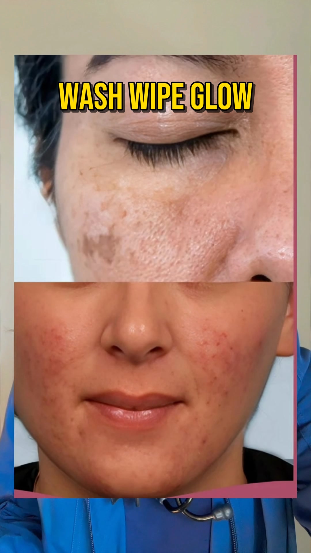 Bright Skin, Simplified
