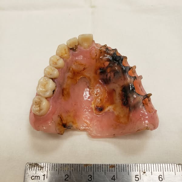 Lisez ceci si vous portez un dentier