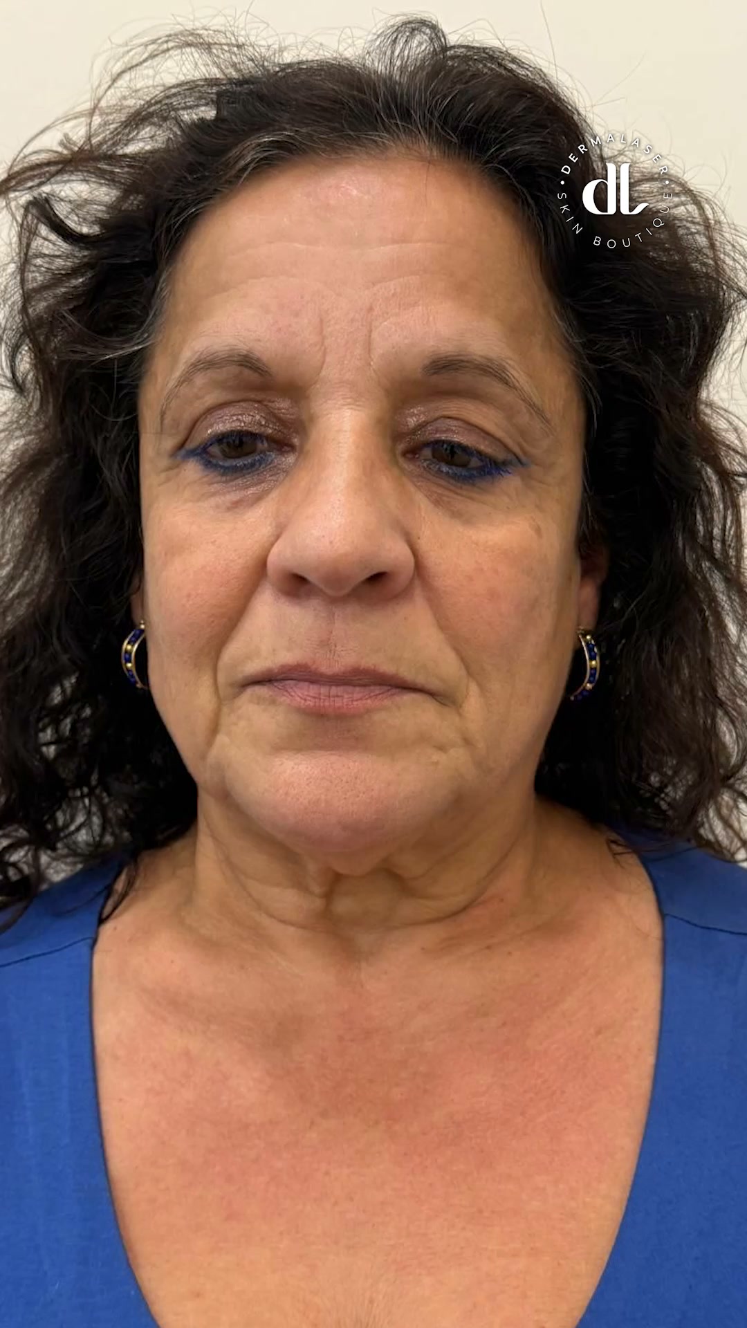 Anúncio de Dermalaser Skin Boutique