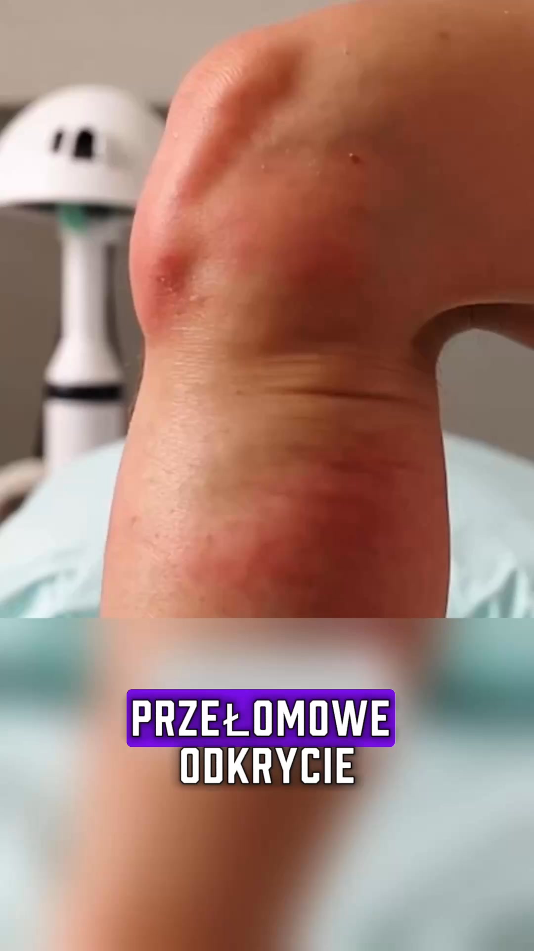 Ulga dla opuchniętych nóg w 15 minut