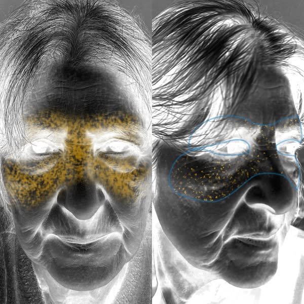 My undereye scans no more bags