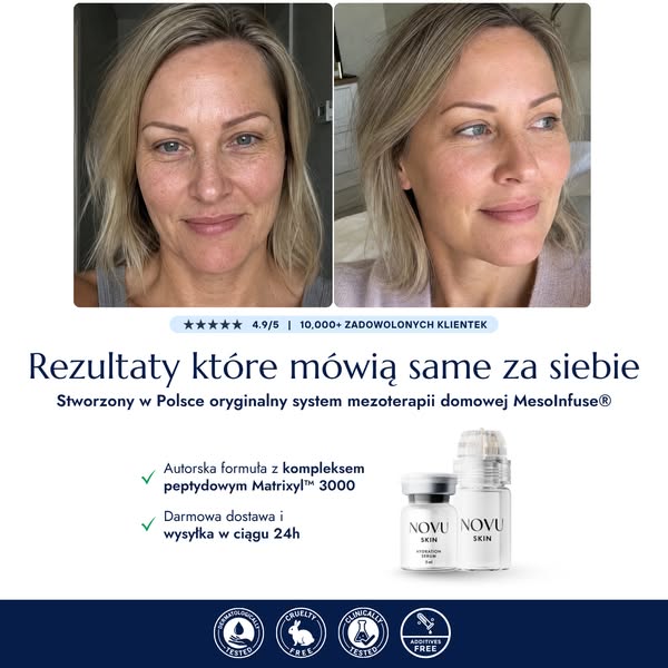 10 000+ Polek wybrało MesoInfuse®