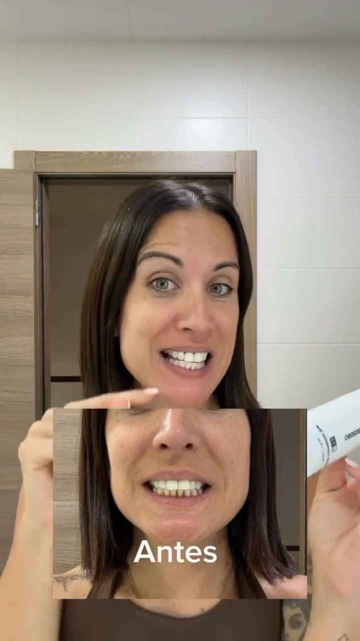"Mis dientes no estaban preparados para esto."