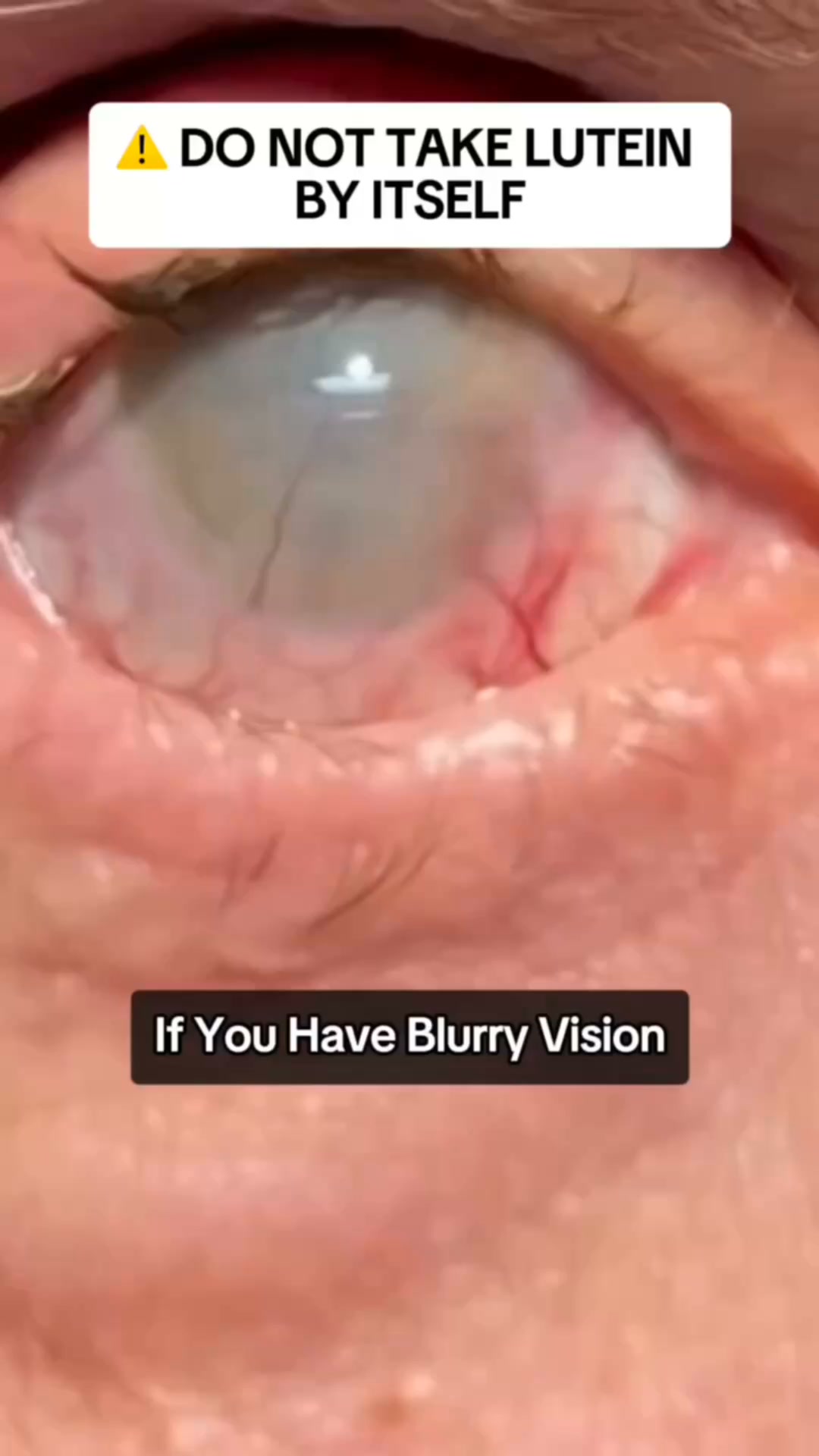 Fight Back Against Macular Degeneration!