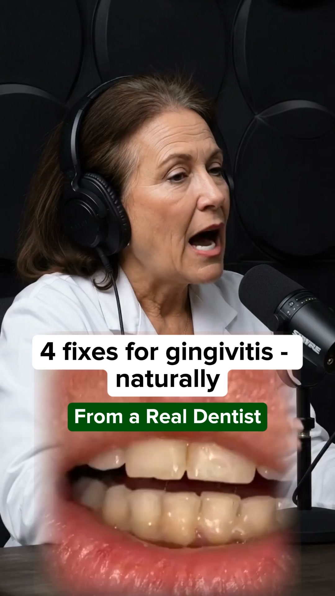 Dentist Developed - Fight Gingivitis at Your Gum Line
