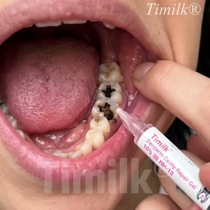 See visible structural filling and natural enamel restoration in just 5 days — rebuild weakened enamel, eliminate pain, and flash your br