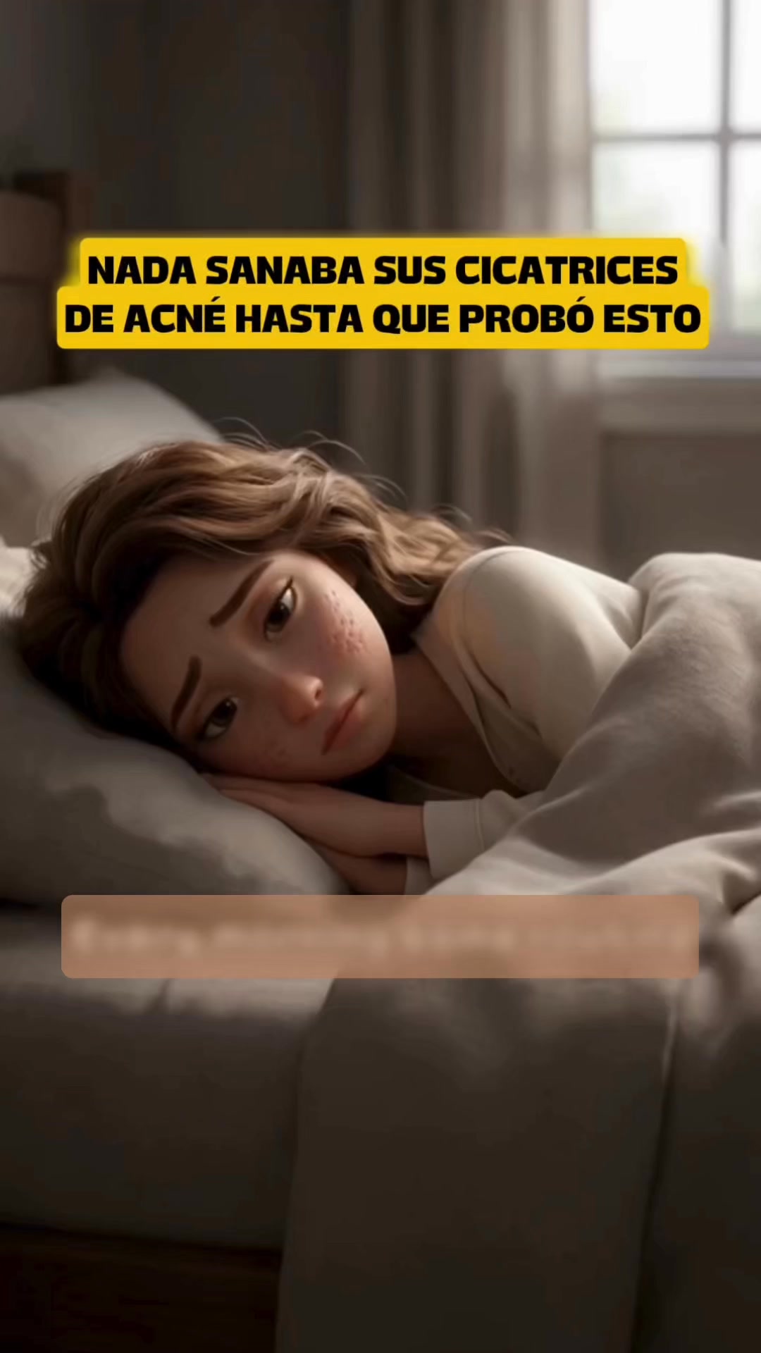 Si Tienes Marcas Mira Esto