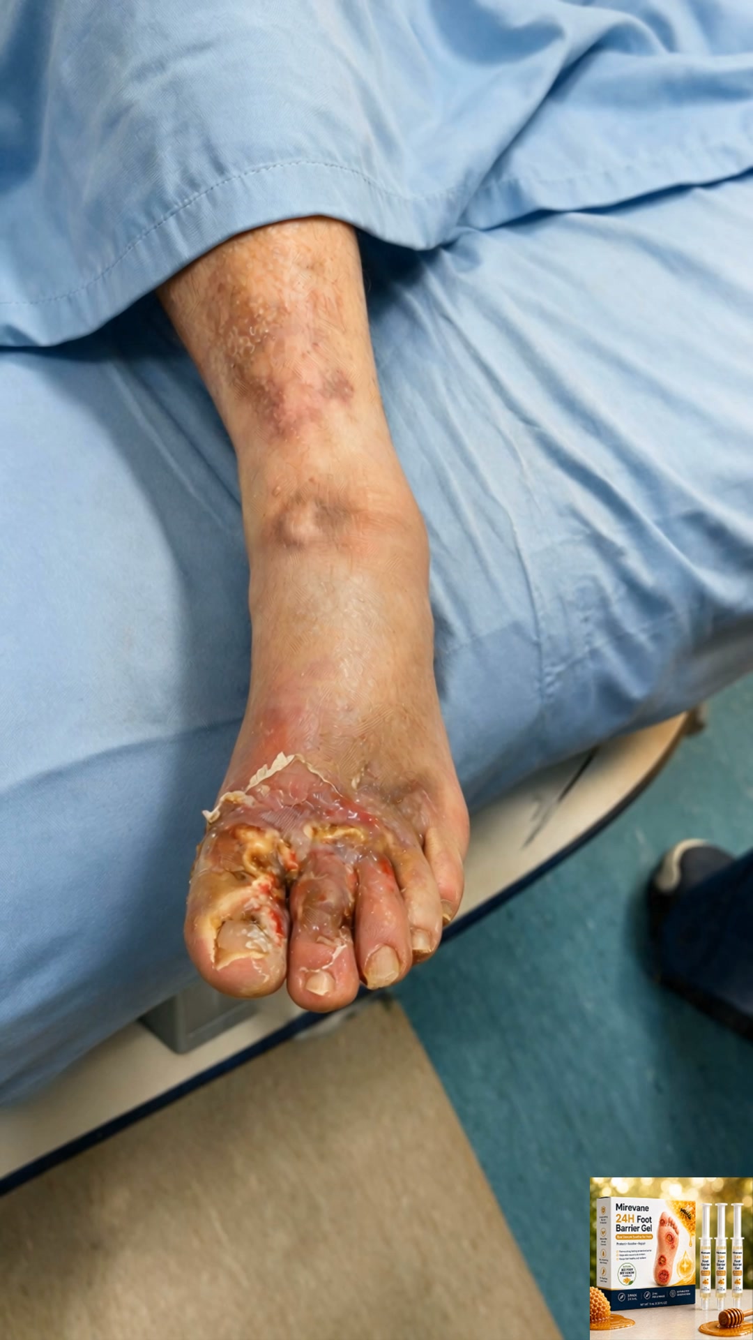 Bee Venom + Botanical Shield — Finally, Foot Care That Actually Protects and Heals.