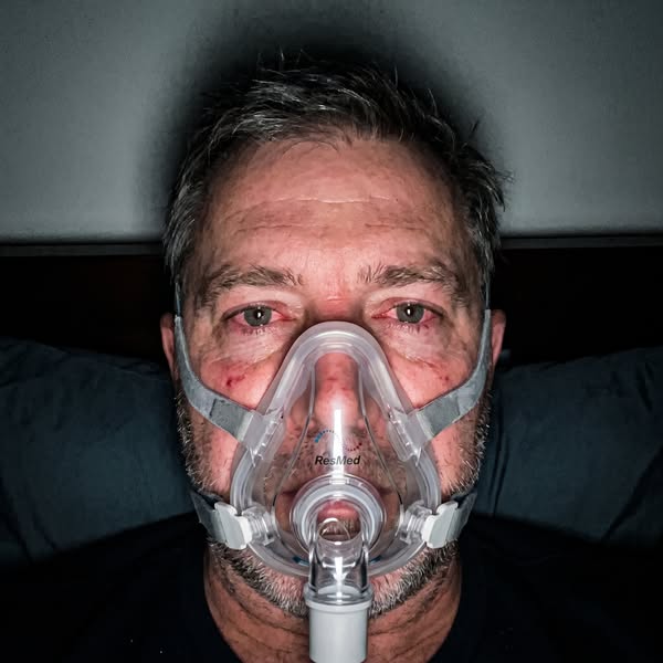 Why CPAP Fails?