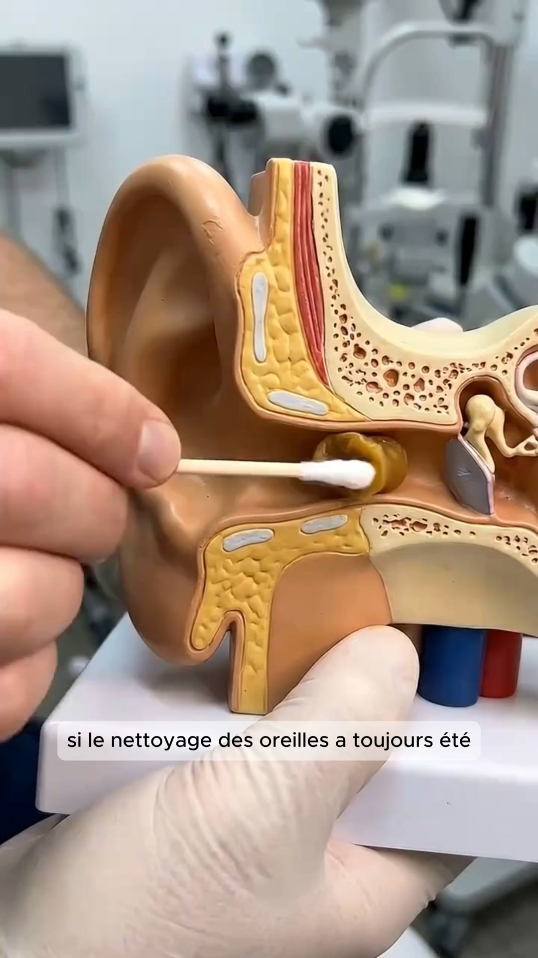 Il attrape le cérumen au lieu de le pousser