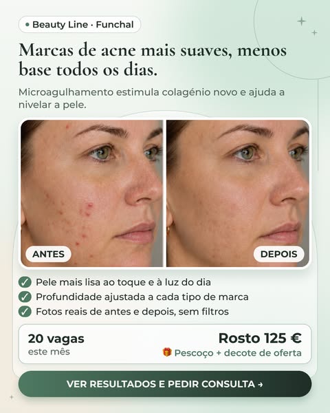 Vê os resultados reais no site