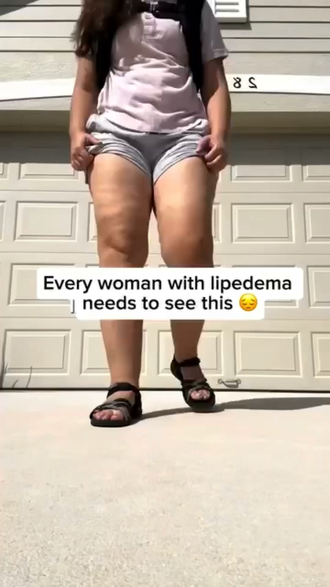 Massage for Cellulite at Home