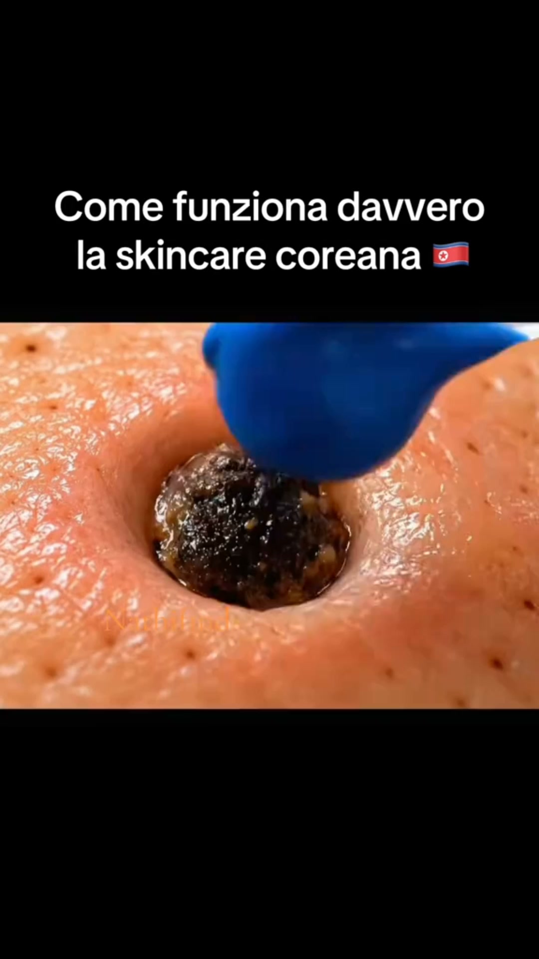Naso e zona T più curati