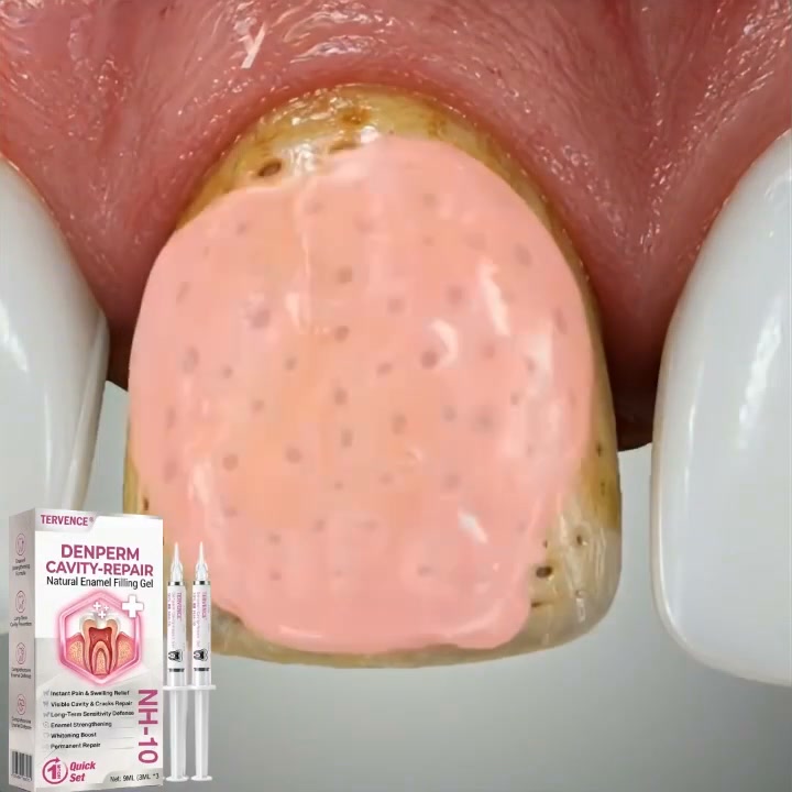 No Drilling, No Pain, No Downtime