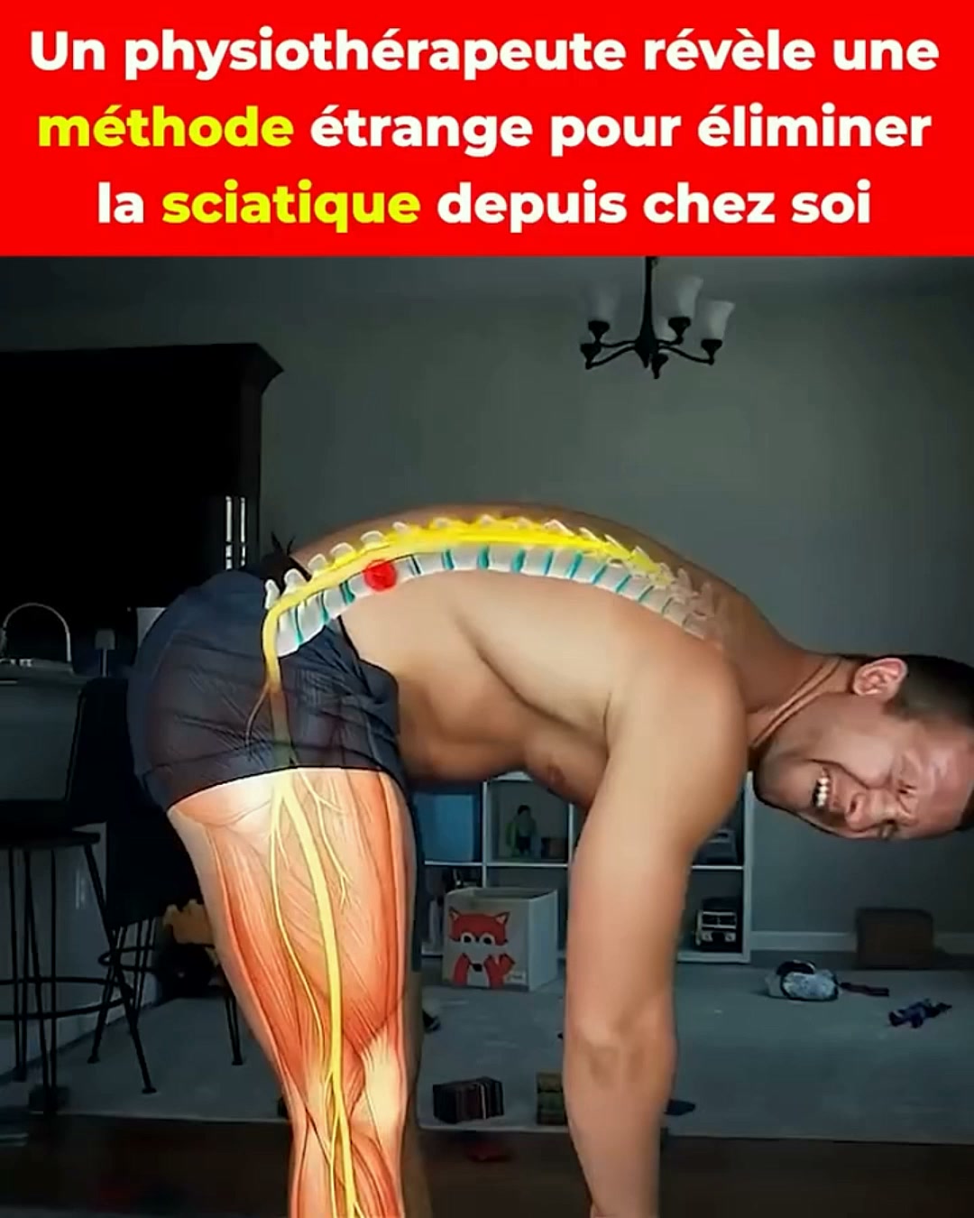 3 Façons de Soulager Votre Scaitique