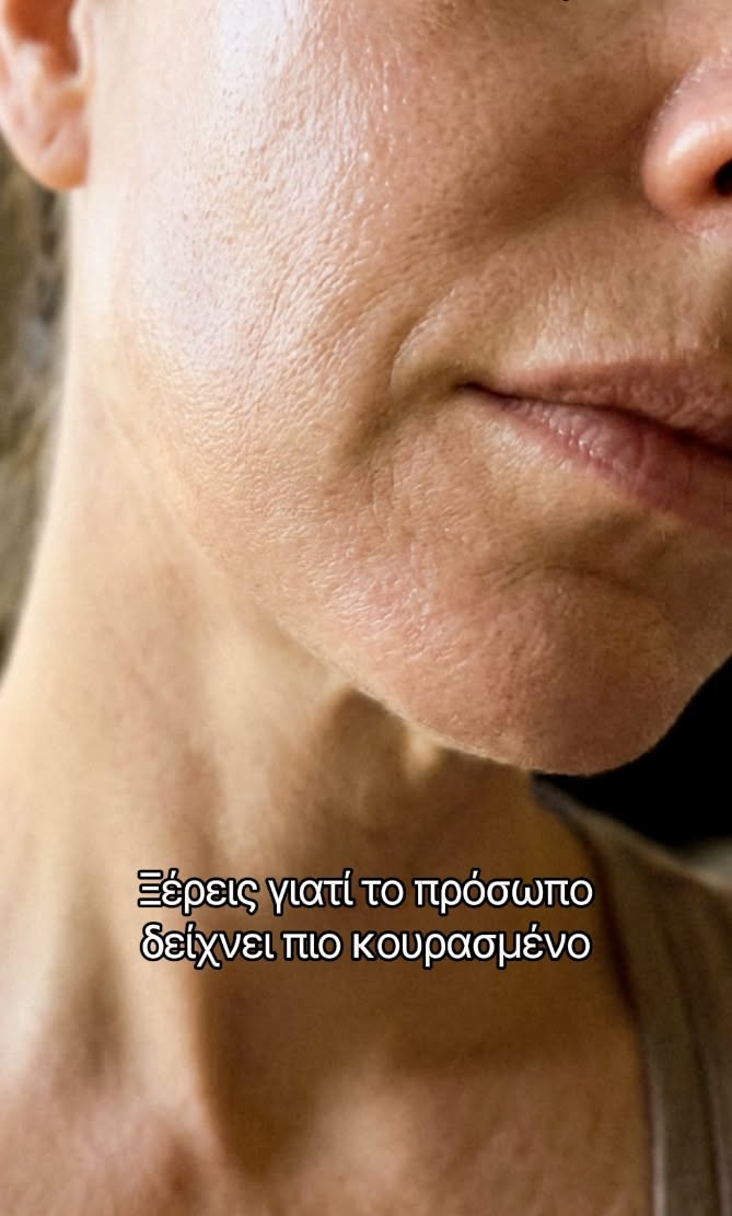 Το καλοκαίρι κούρασε το δέρμα σου