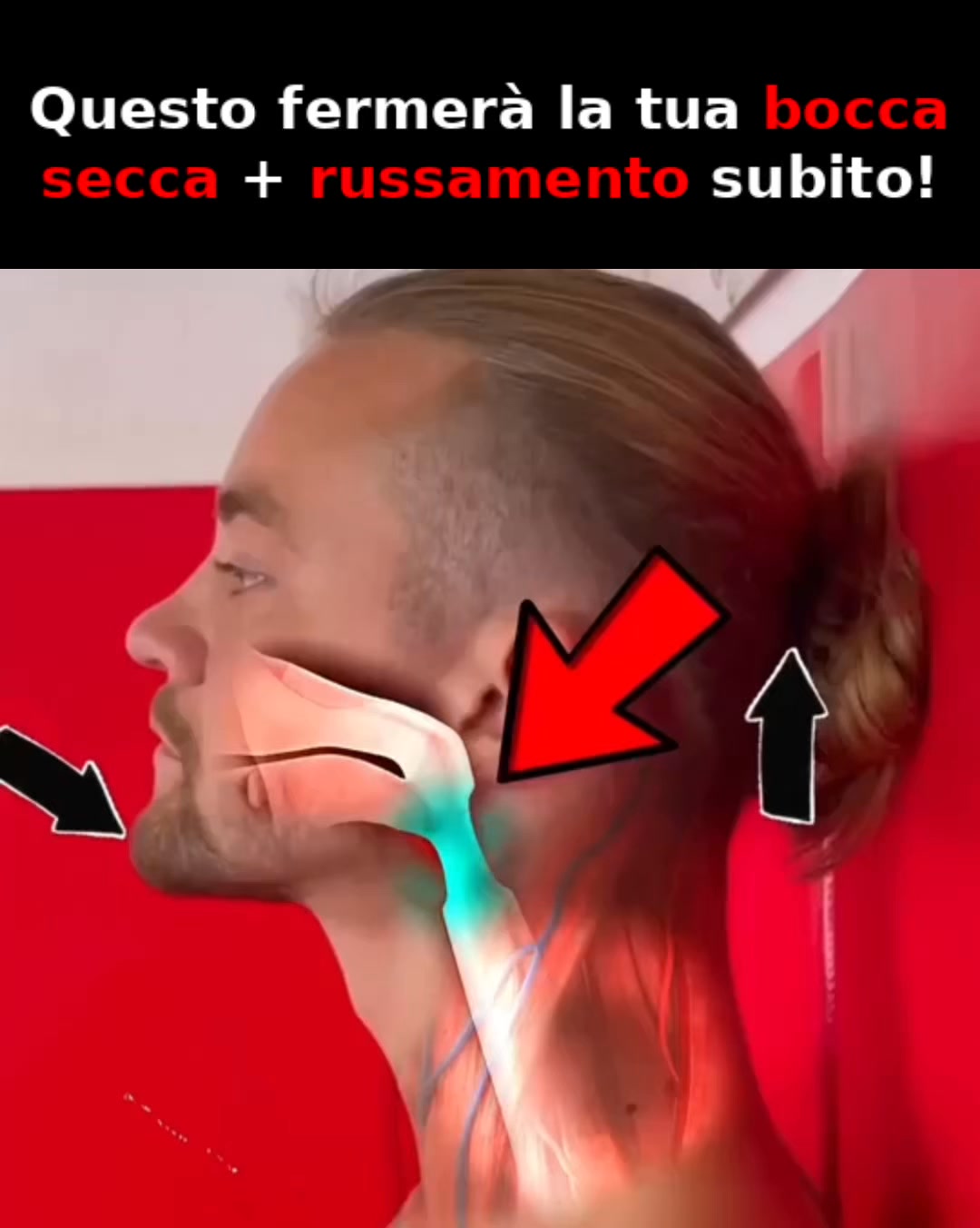 Basta Russare! Dormi Meglio!