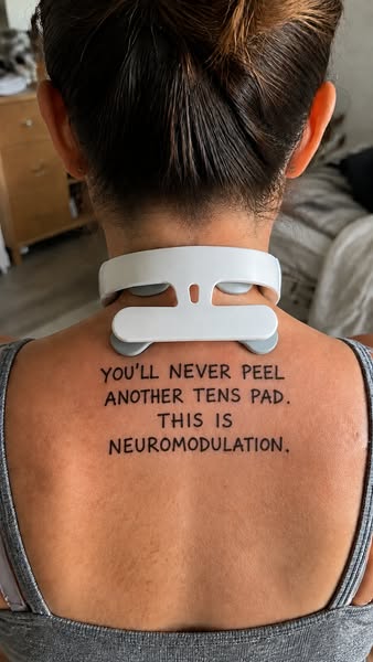 Neuromodulation Made for Fibro Bodies