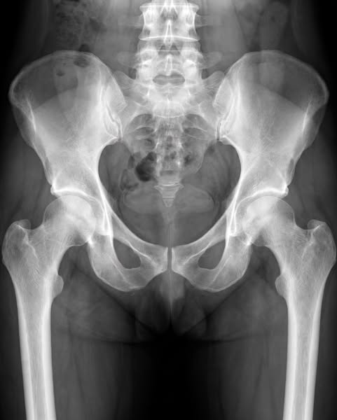 The Scan Showed A Textbook Recovery. It Didn't Show This.