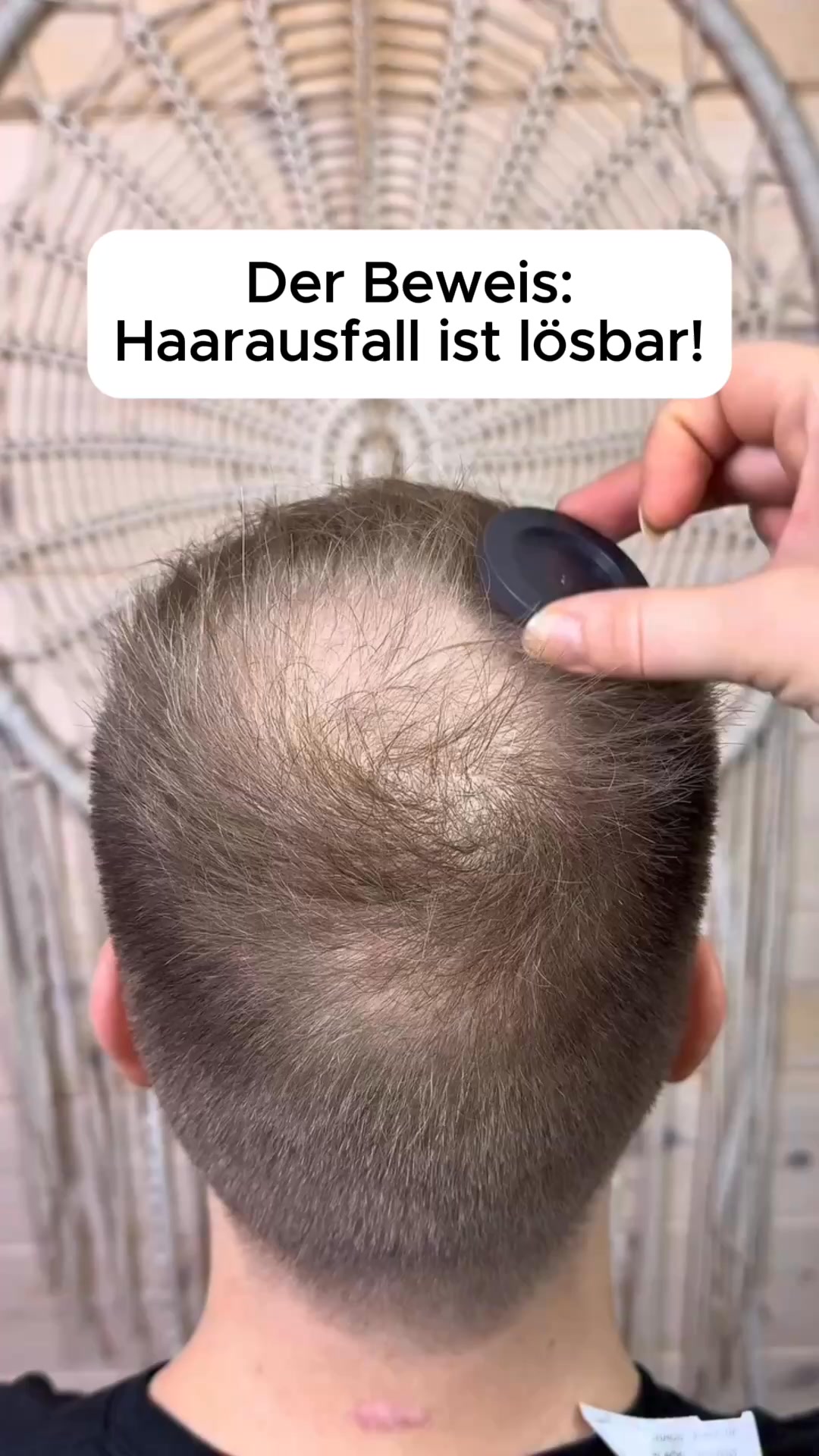 Hol dir noch heute volleres und dickeres Haar zurück!
