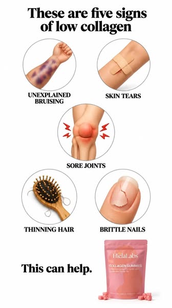 Help Rebuild Your Skin’s Cushion