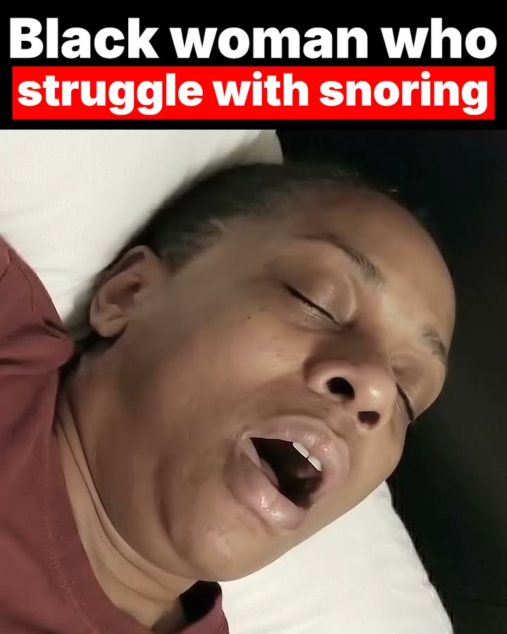 Snoring Stops Here!