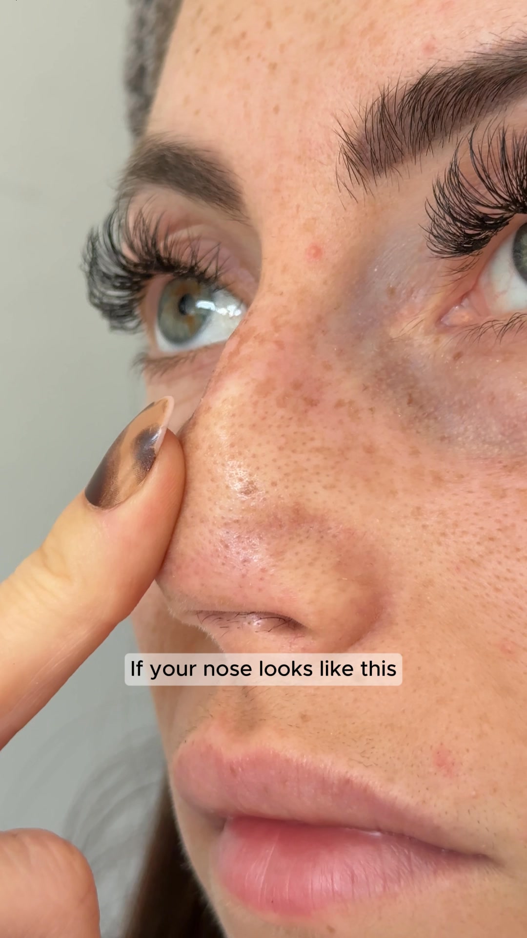 Clear Nose Overnight