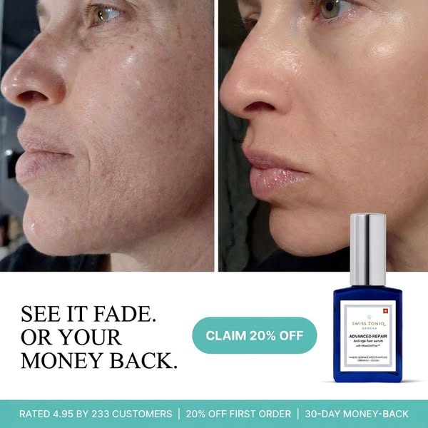 Sun Damage Fades Slower At 40