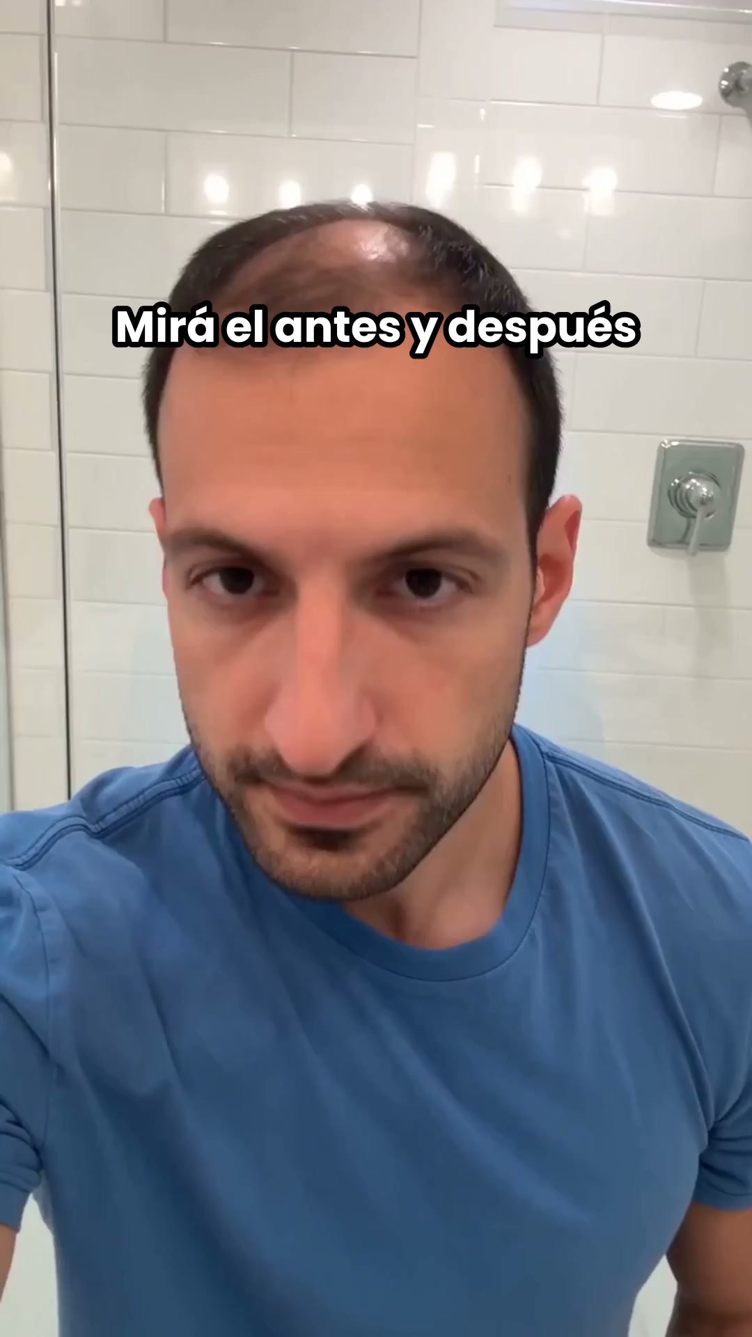 Cabello Más Abundante y Fuerte