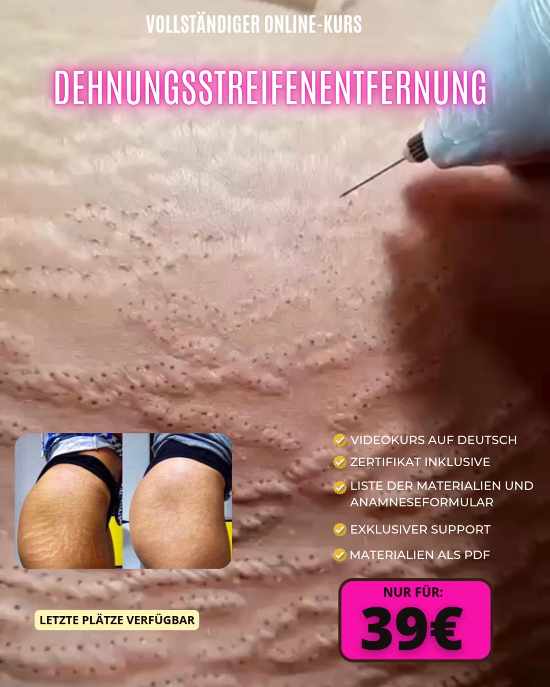 Klicke auf „MEHR ERFAHREN“