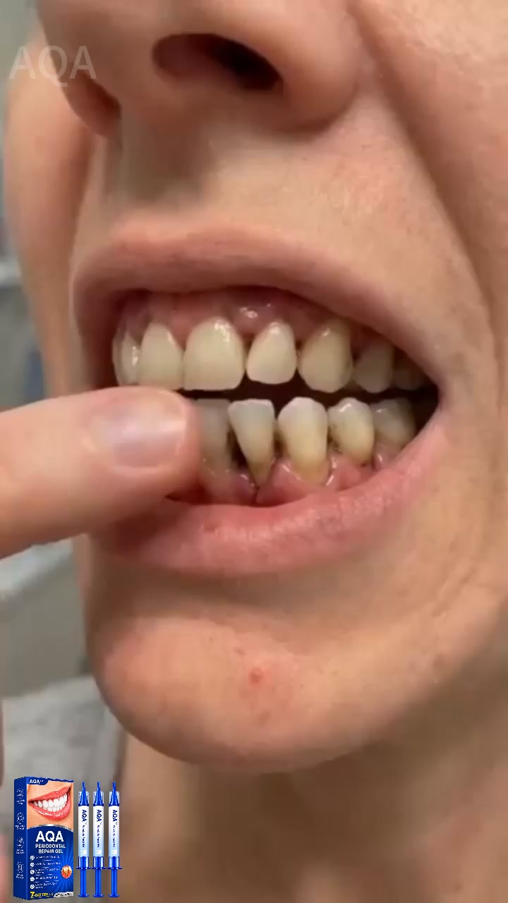 Better Gum Care Starts Here