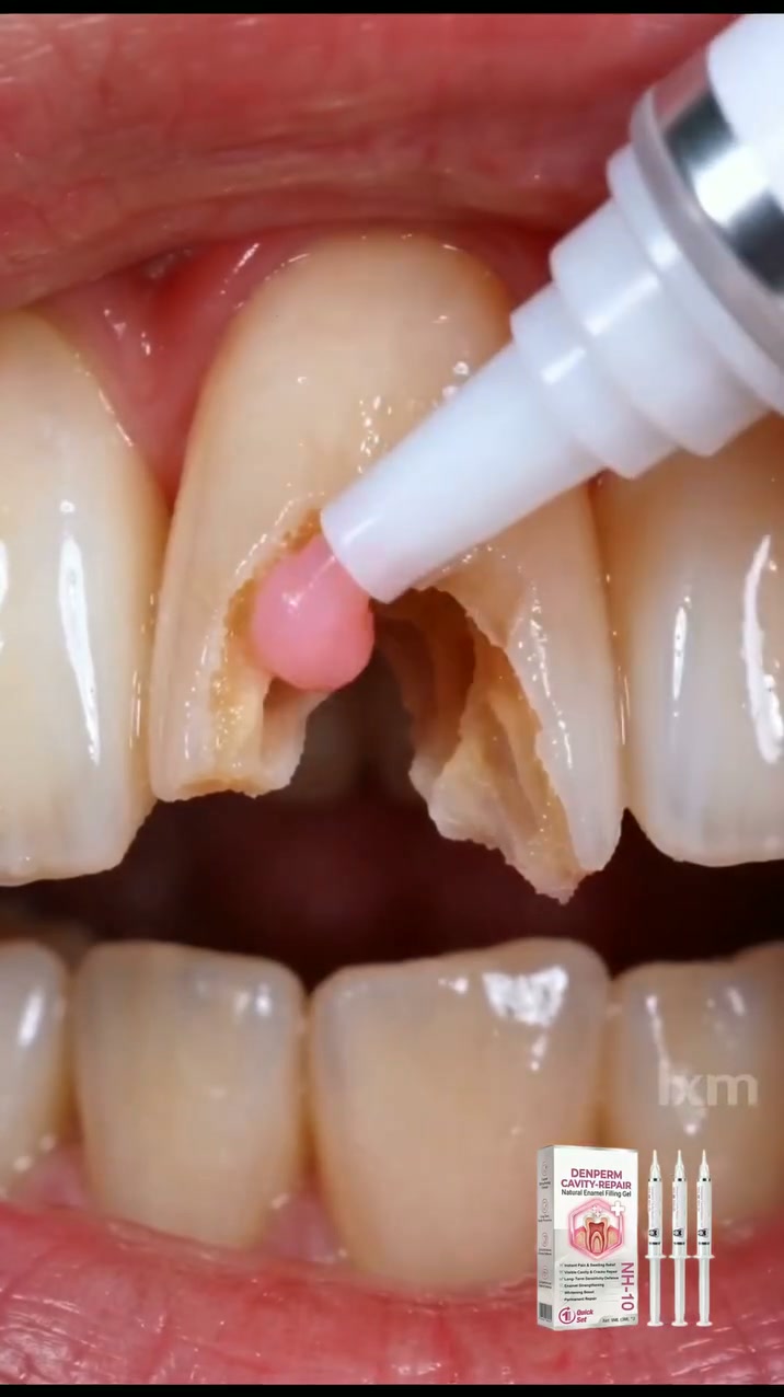 Cavity Repair FDA-Recognized 10% Nano-Hydroxyapatite (NH-10) | Delivery within 2-4 working days | Full refund guarantee