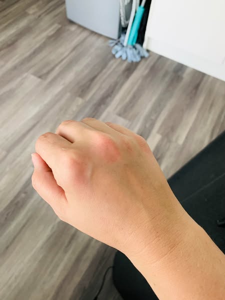 Lees dit als opstaan pijn doet