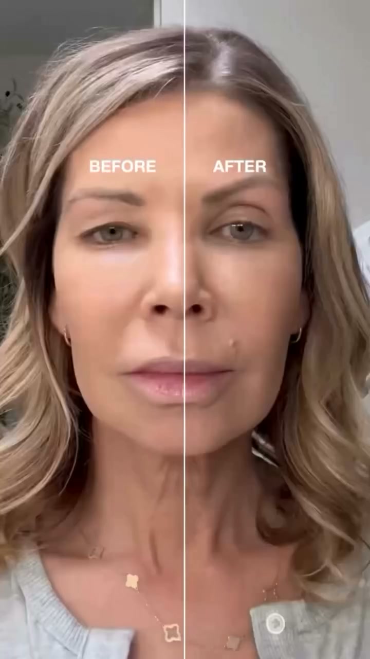 Natural Invisible Eyelid