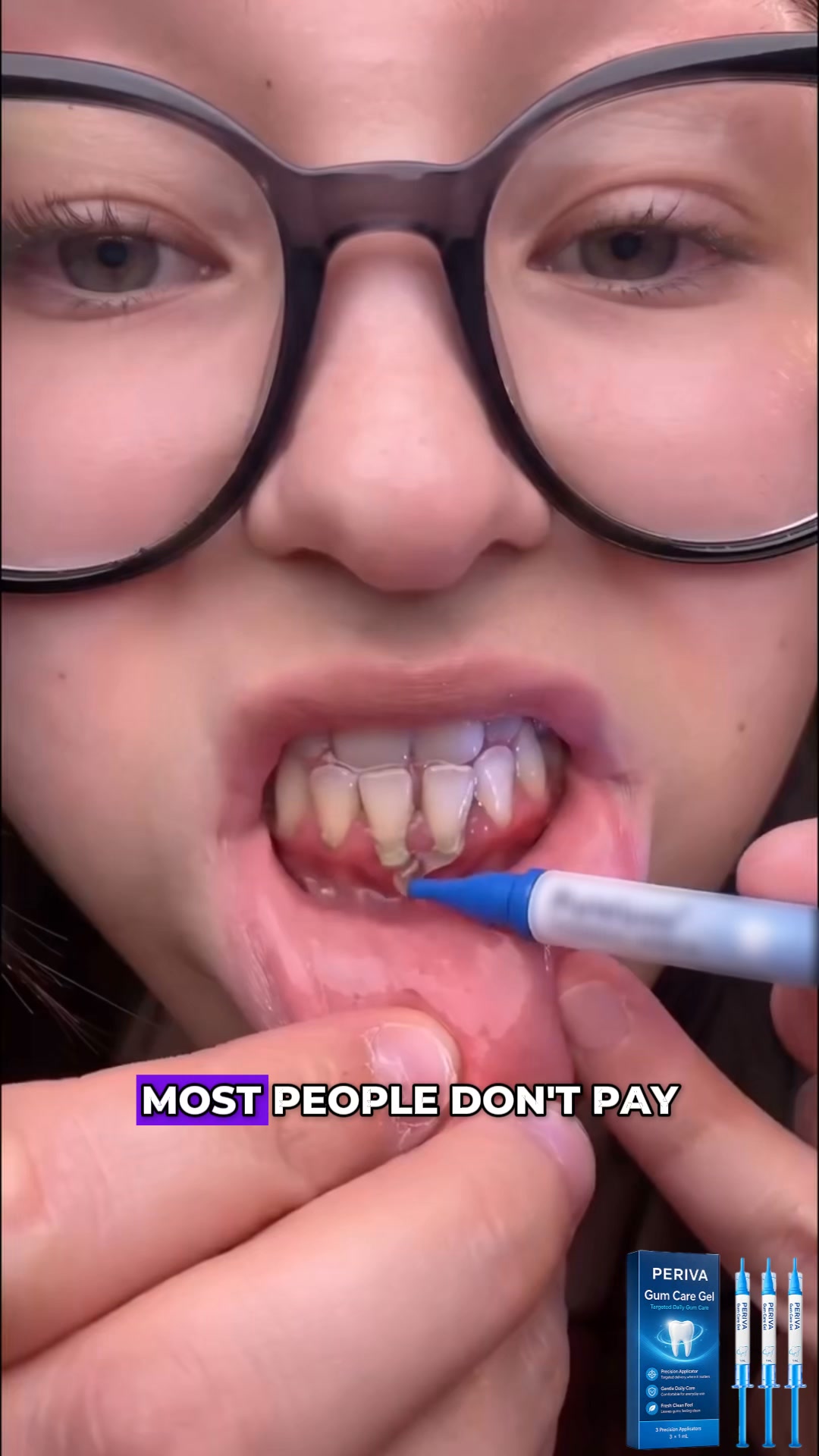 The 60-Second Bedtime Trick For Receding Gums
