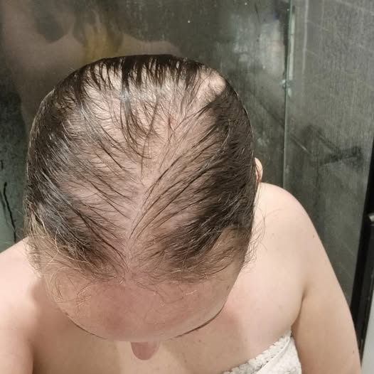 Thinning Hair? Read This.