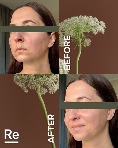 The science of balanced skin