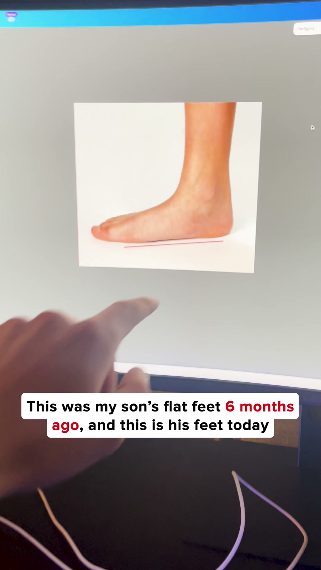 Support Flat Feet the Right Way