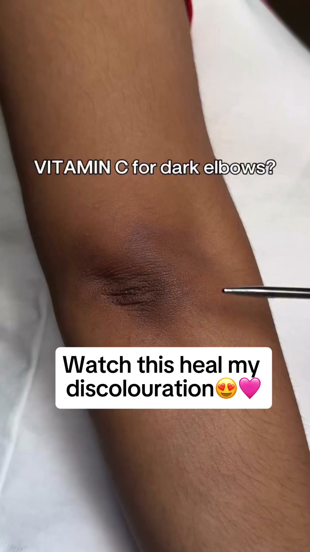 Brighter, More Even-Looking Skin