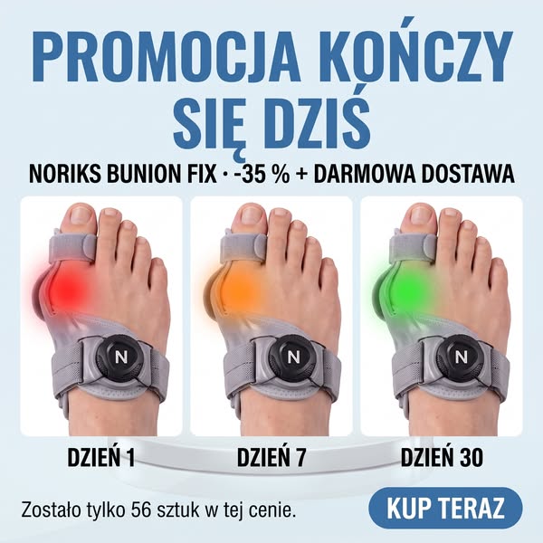 Bolesne haluksy? Wypróbuj to rozwiązanie.