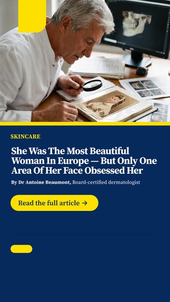 She was the most beautiful woman in Europe — but only one area of her face obsessed her