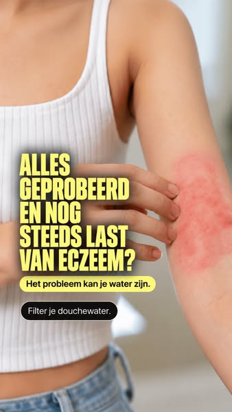 Dé oplossing tegen een trekkerige huid