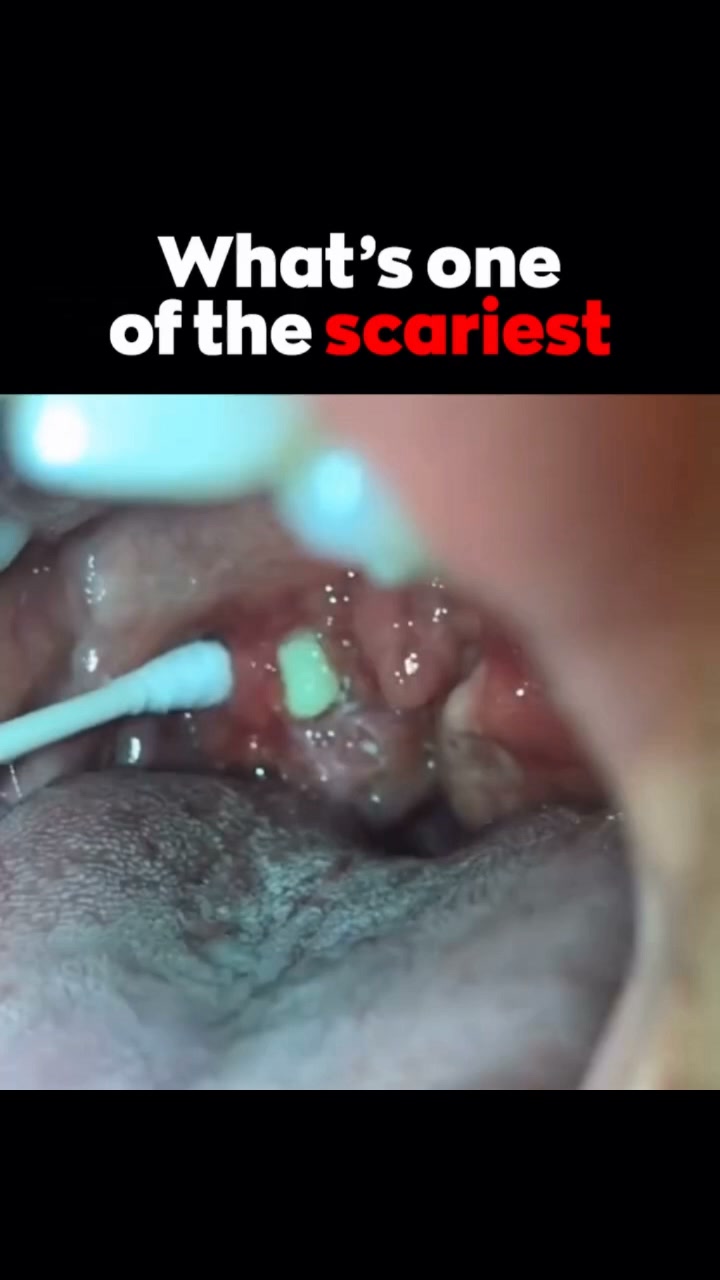 Stop Snoring. Sleep Better Tonight.