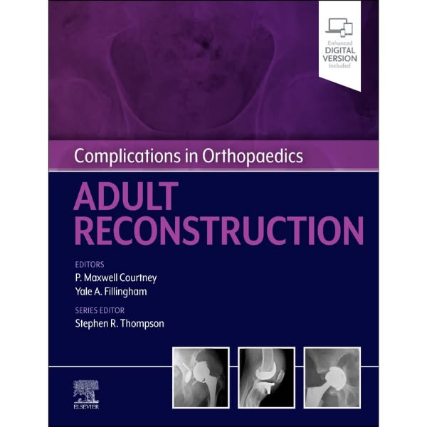 Real-world THA & TKA complication protocols for orthopaedic surgeons.