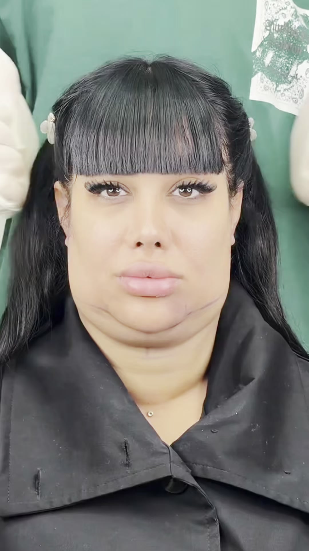 Learn Double Chin Reduction | Only $20