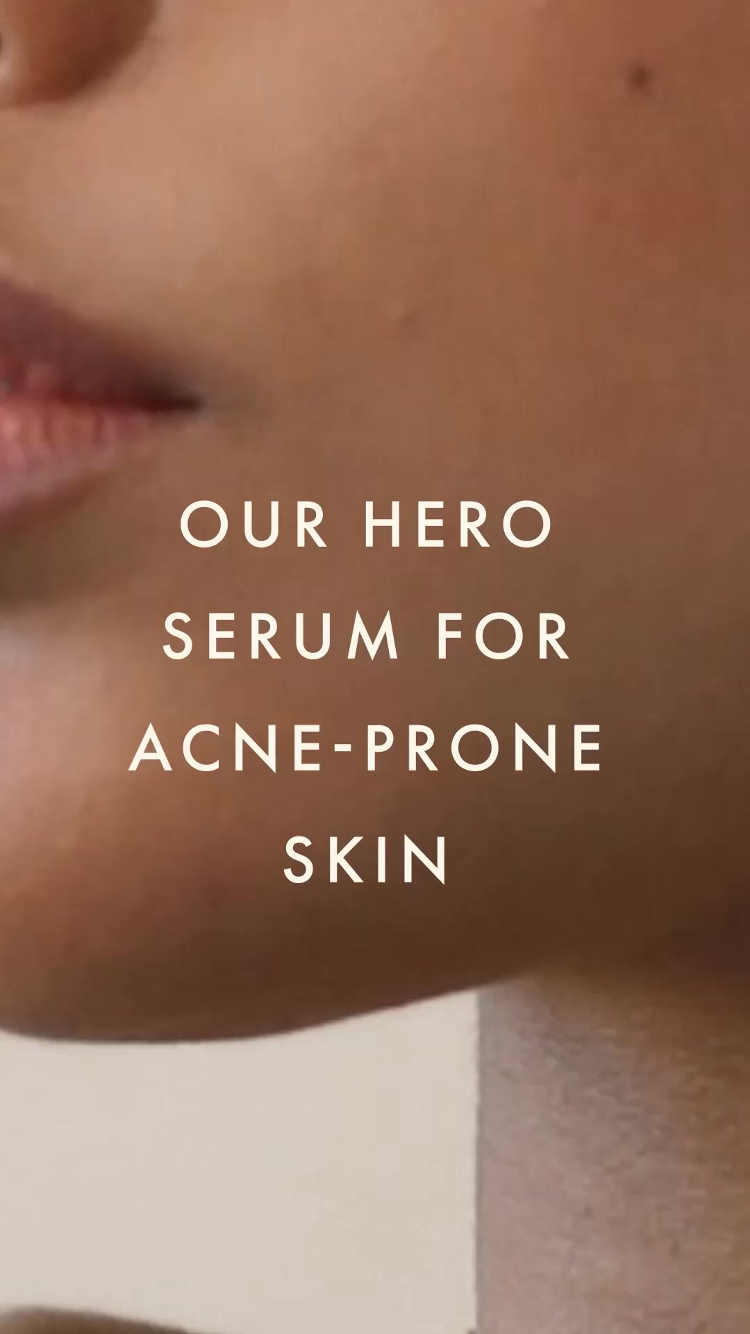 A Refined Ritual for Acne-Prone Skin
