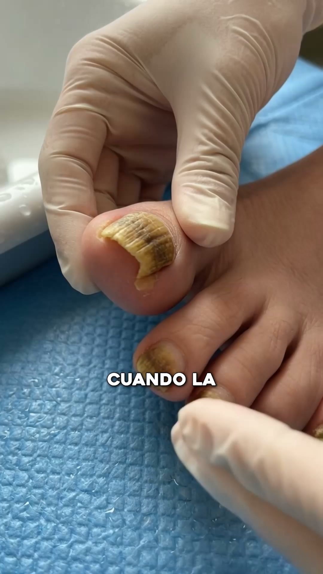 El aceite llega donde la crema no