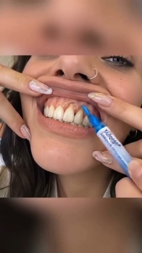 Give Your Gumline the Care It Deserves