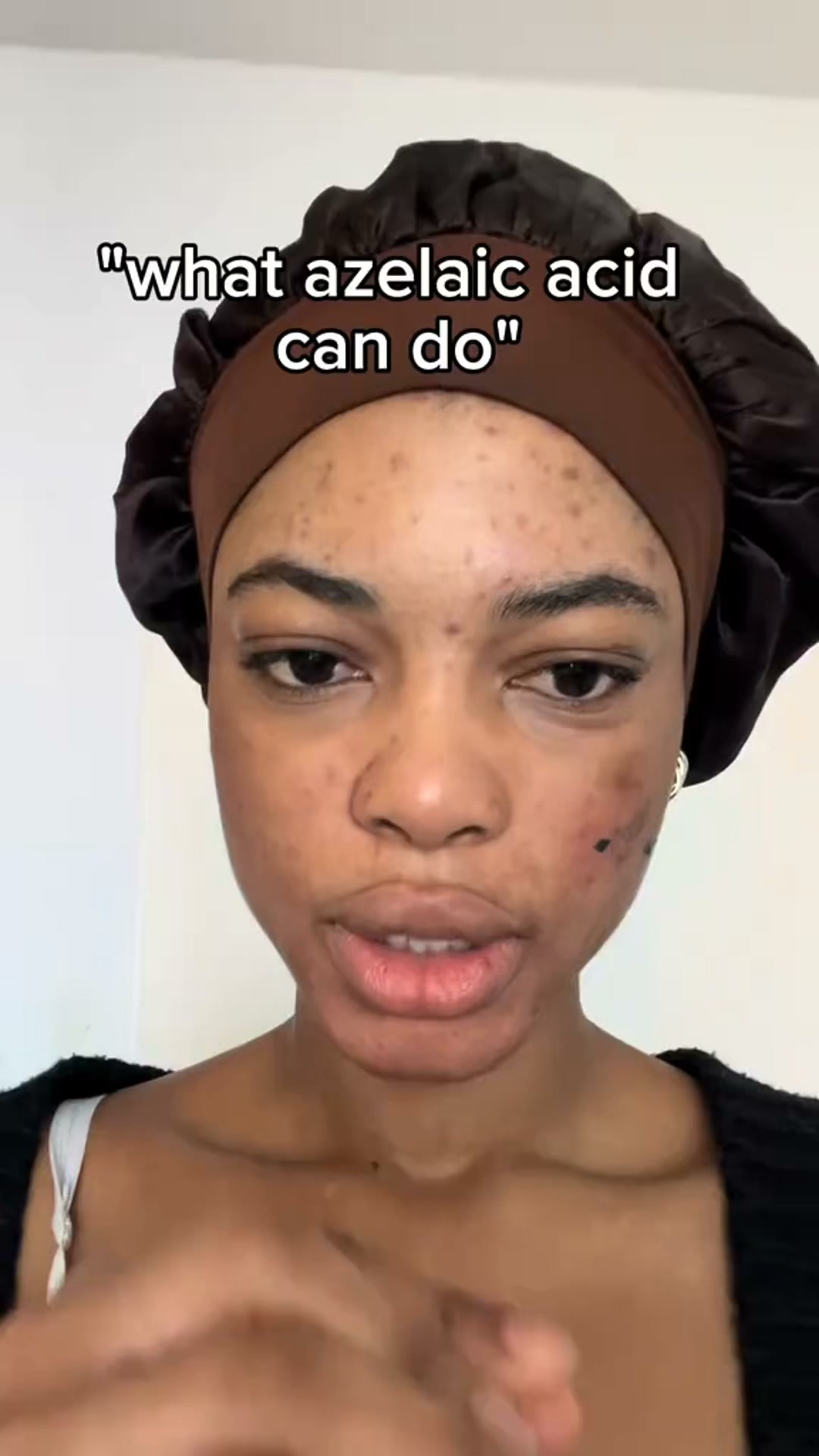 Calmer, Clearer-Looking Skin