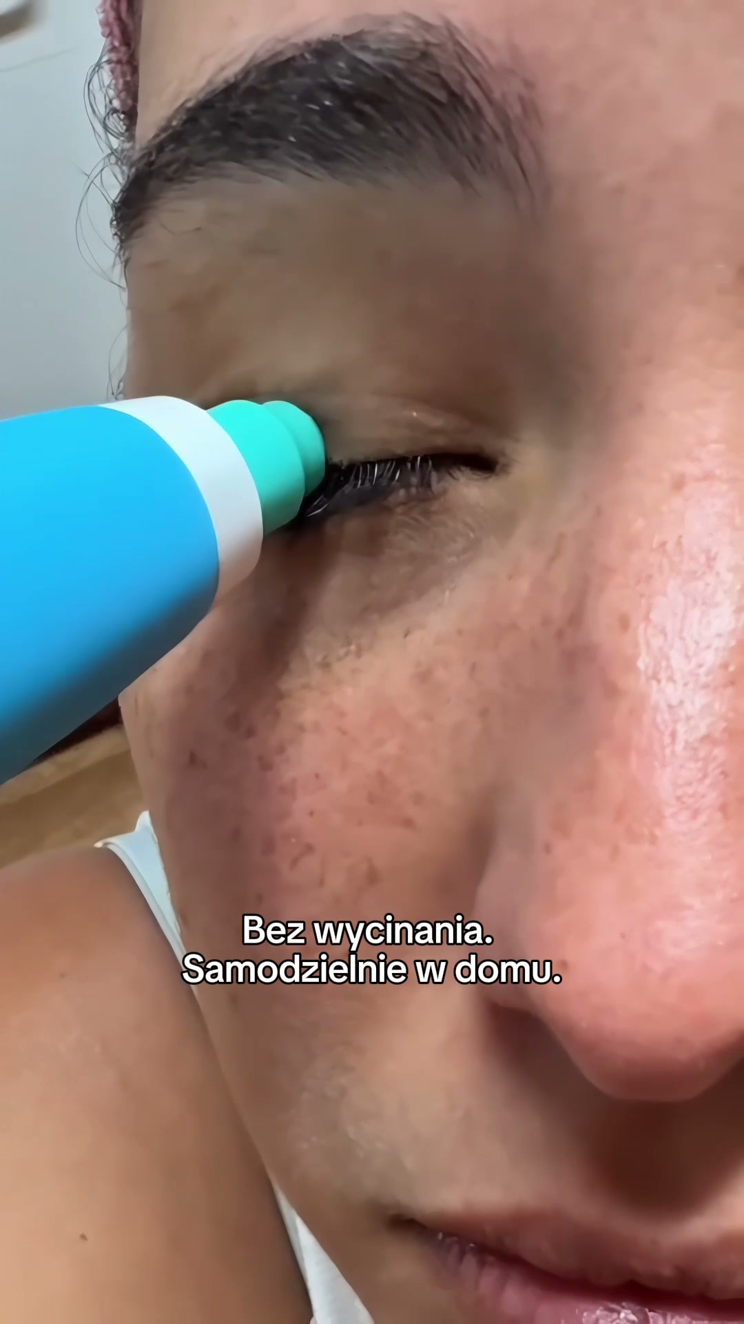 Nie musisz jej wycinać